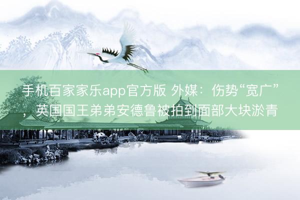 手机百家家乐app官方版 外媒：伤势“宽广”，英国国王弟弟安德鲁被拍到面部大块淤青